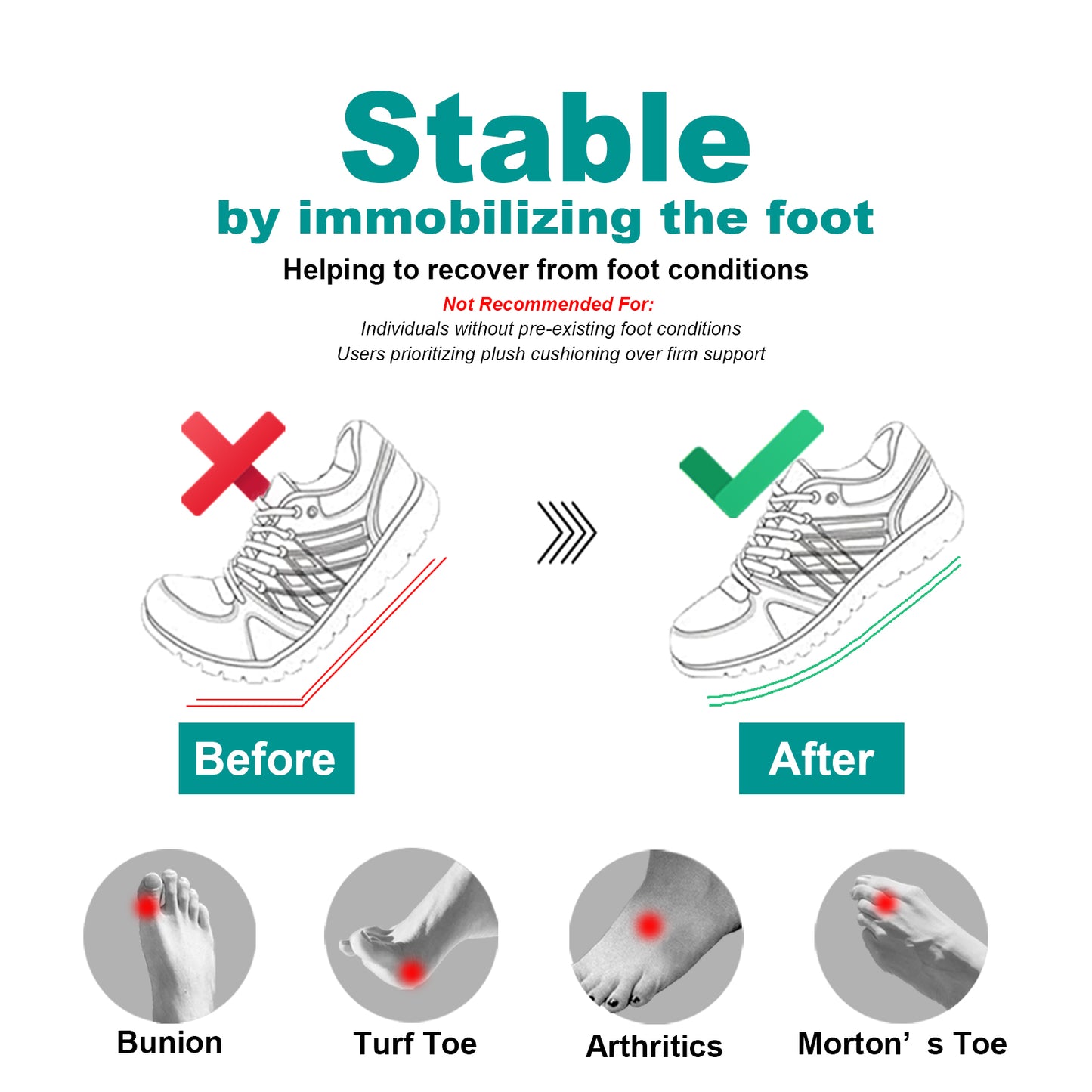 Carbon Fiber Flat Recovery Plates